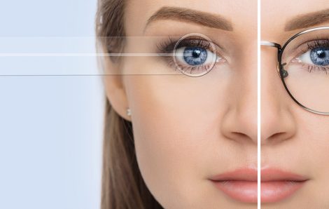 Comprehensive Understanding of PRK Laser Eye Surgery