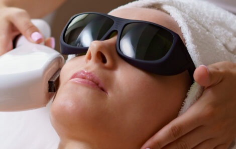 What You Need to Know Before Getting Intense Pulsed Light Therapy