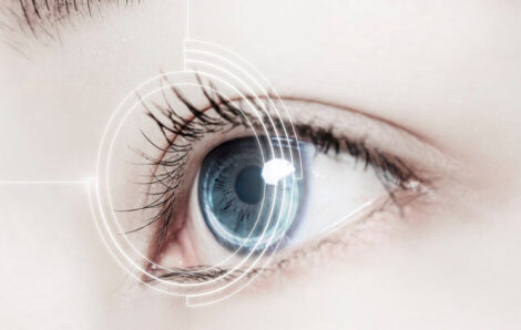 Important Things You Need to Know About LASIK Eye Surgery