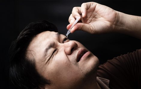 IPL vs Eye Drops: Which Treats the Root Cause of Dry Eye?